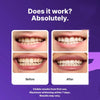 Purple Teeth Whitening Strips